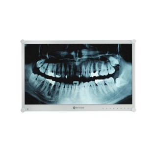 Neovo - Ecran médical 23,6p Full HD EN60601, IEC60601-1 - Métal blanc AG Neovo