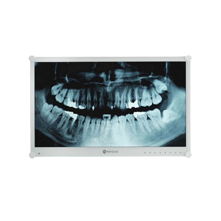 Neovo - Ecran médical 23,6p Full HD EN60601, IEC60601-1 - Métal blanc AG Neovo