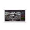 Neovo - Ecran médical FHD 22p chassis métal blanc et dalle en verre AG Neovo